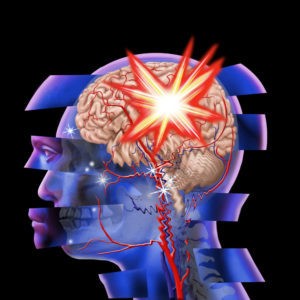 What Are The Signs of a Traumatic Brain Injury?