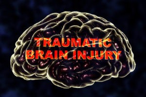 What Happens to the Brain During a Traumatic Brain Injury