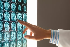 Types of Construction Accidents that Can Lead to Brain Injuries