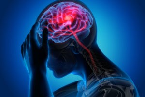 Hicksville Brain Injury Lawyer