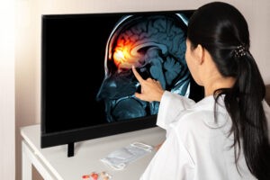 How Much Is the Average Brain Injury Settlement?